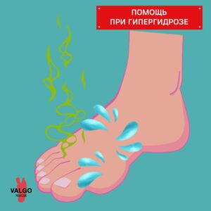 потливость стоп