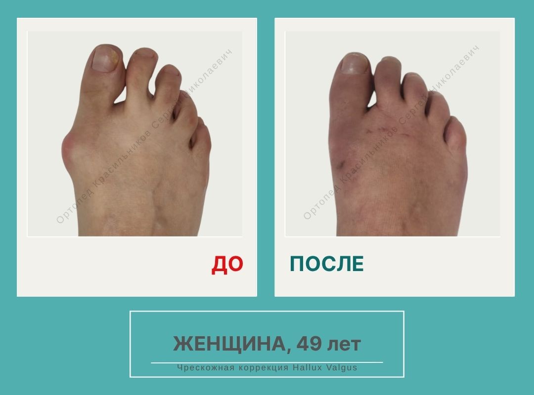 КСН ДО ПОСЛЕ НА САЙТ_Багина О.А.