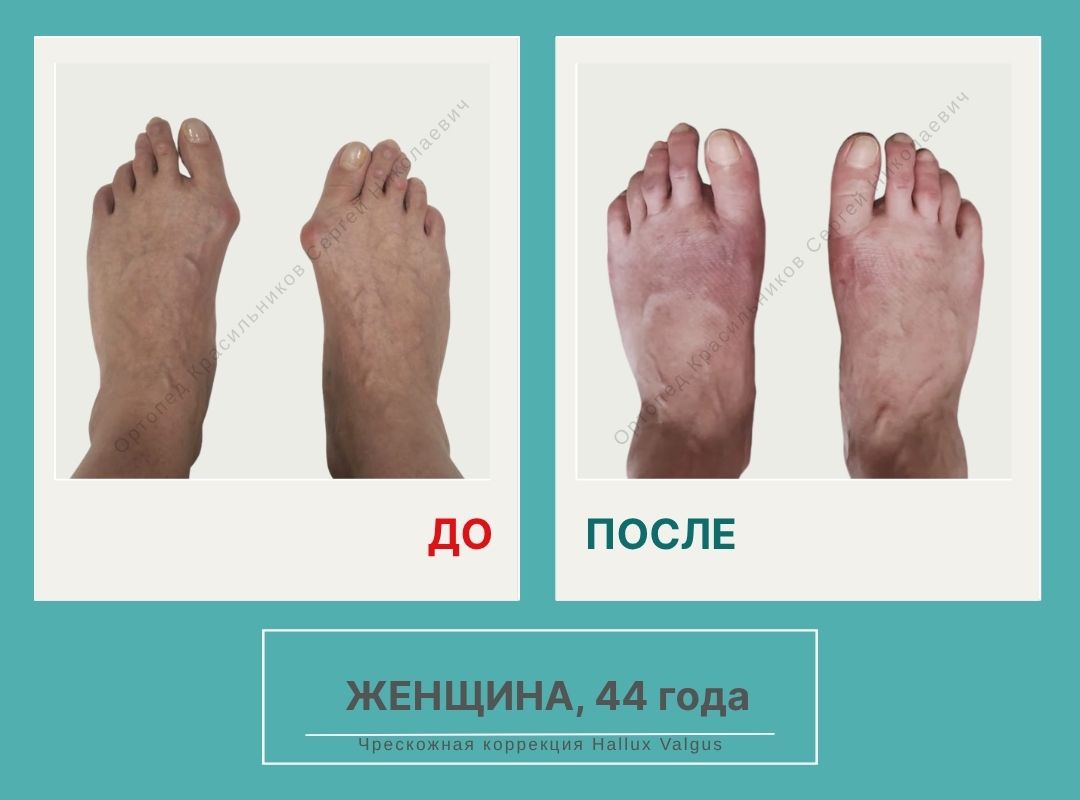 КСН ДО ПОСЛЕ НА САЙТ_Ерохина Э.Т.