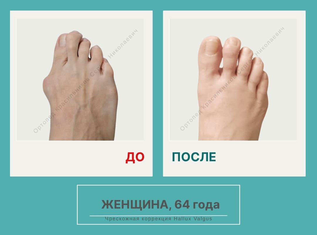 КСН ДО ПОСЛЕ НА САЙТ_Злобина Н.И.