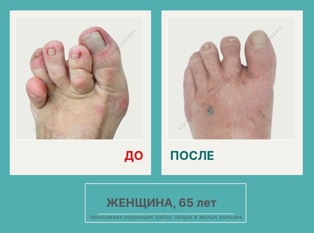 КСН ДО ПОСЛЕ НА САЙТ_Злотникова А.Е.