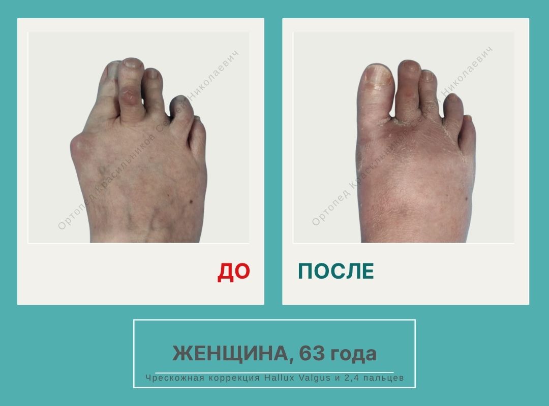 КСН ДО ПОСЛЕ НА САЙТ_Иванова С.М.