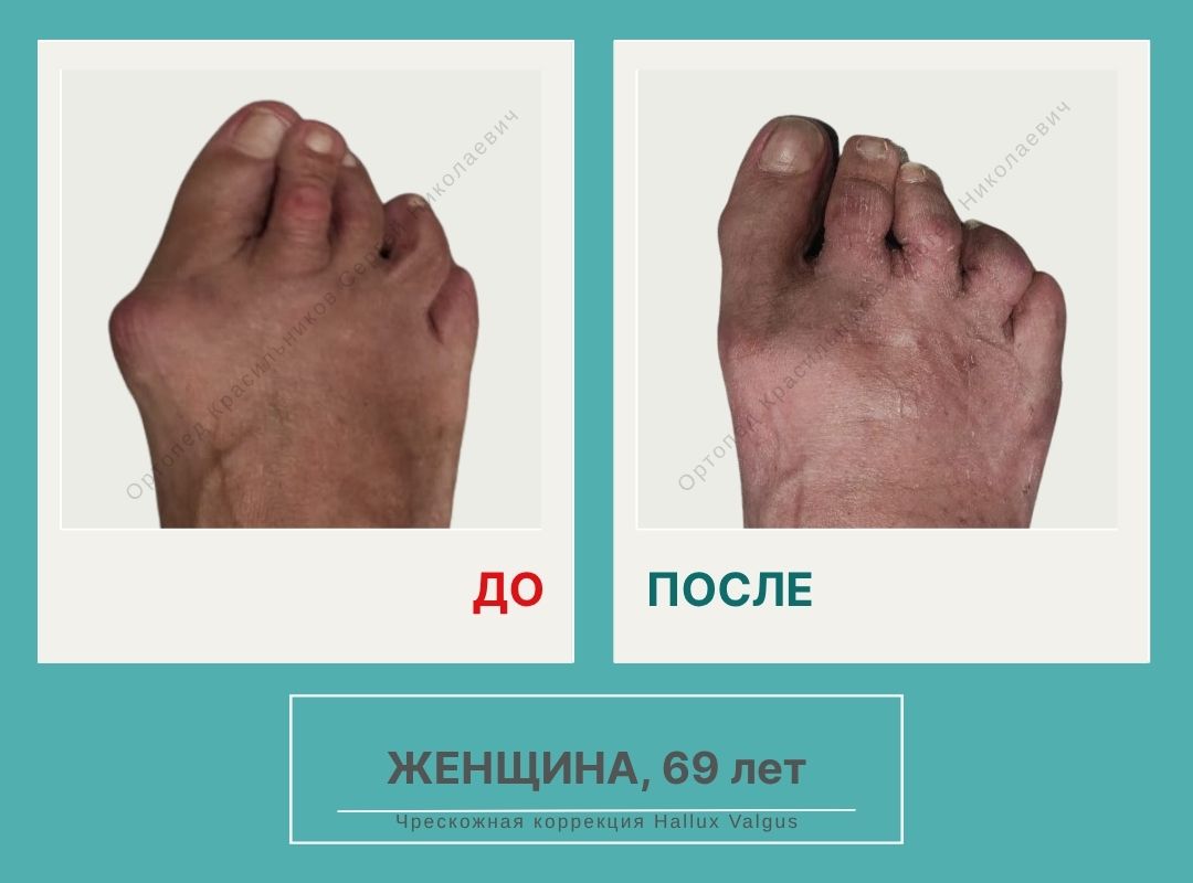 КСН ДО ПОСЛЕ НА САЙТ_Леонова Т.И.