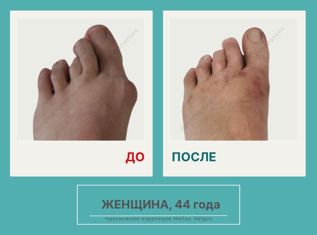 КСН ДО ПОСЛЕ НА САЙТ_Леошко Ю.И.