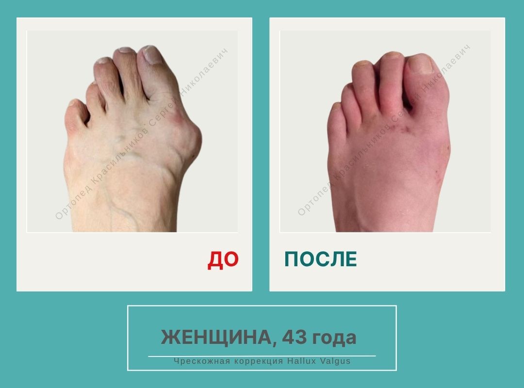 КСН ДО ПОСЛЕ НА САЙТ_Рябцева А.В.
