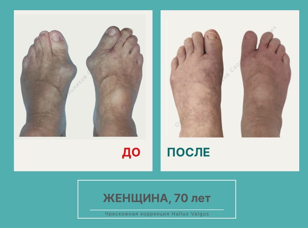 КСН ДО ПОСЛЕ НА САЙТ_Селихова С.Н.