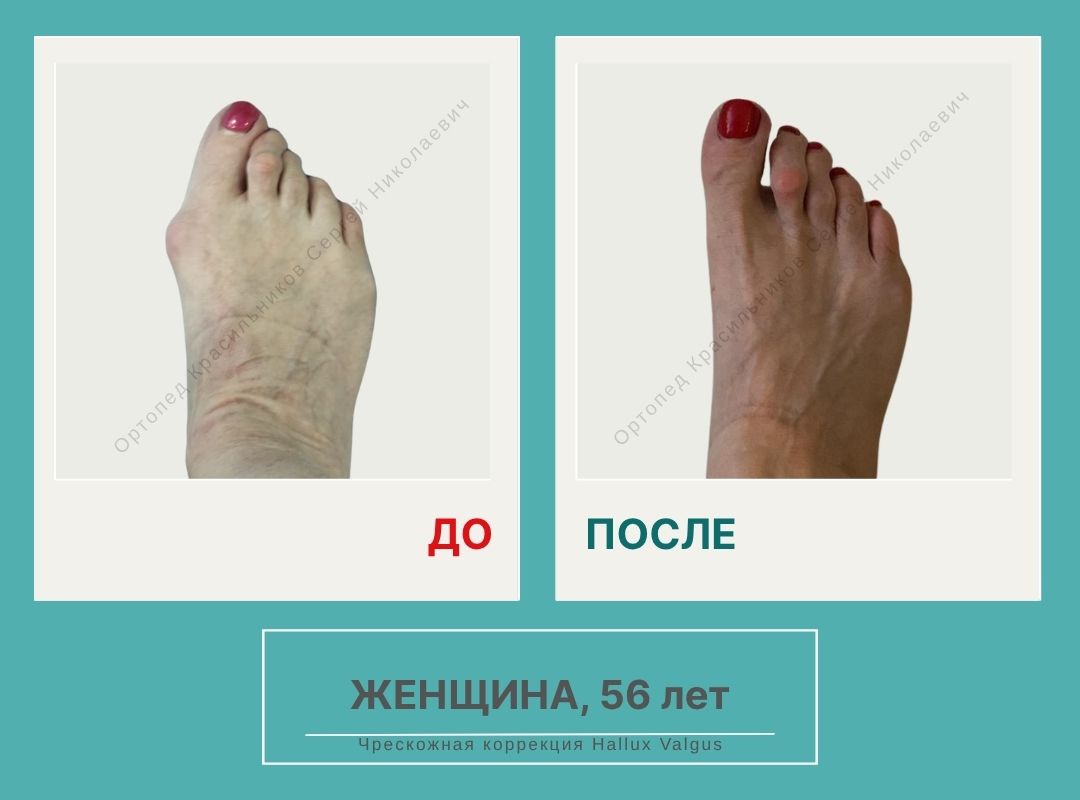КСН ДО ПОСЛЕ НА САЙТ_Цой Т.А.