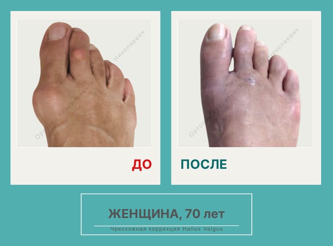 КСН ДО ПОСЛЕ НА САЙТ_Шелест Т.Т.