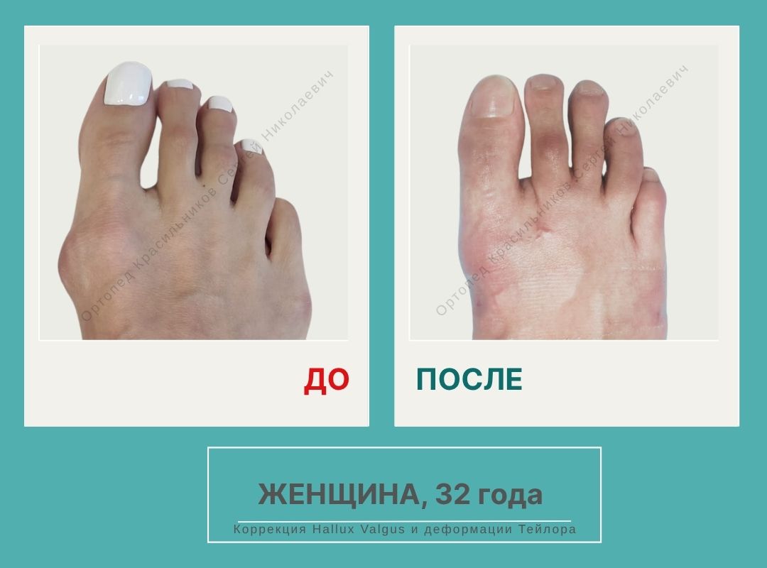 КСН ДО ПОСЛЕ НА САЙТ_Агузарова А.А