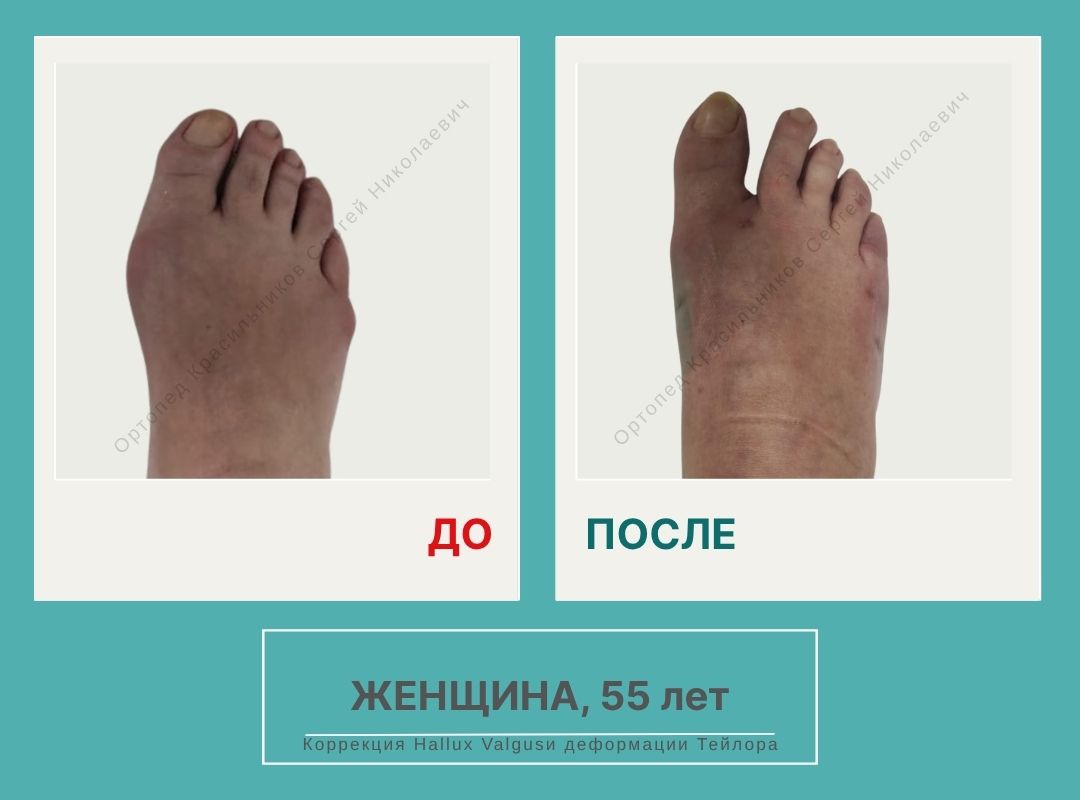 КСН ДО ПОСЛЕ НА САЙТ_Гришунина Е.В.