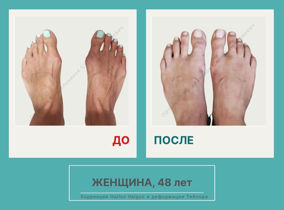 КСН ДО ПОСЛЕ НА САЙТ_Кузнецова Мария