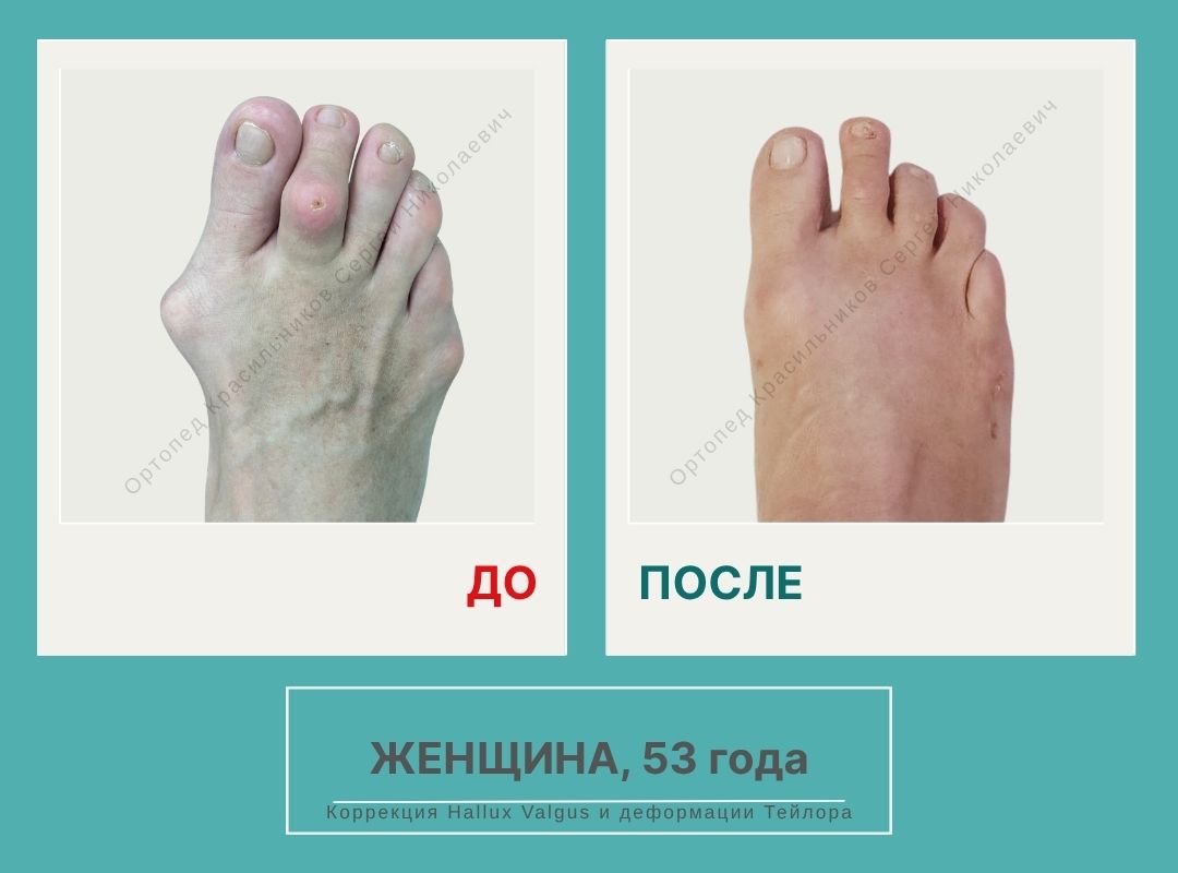 КСН ДО ПОСЛЕ НА САЙТ_Феоктистова Е.В.