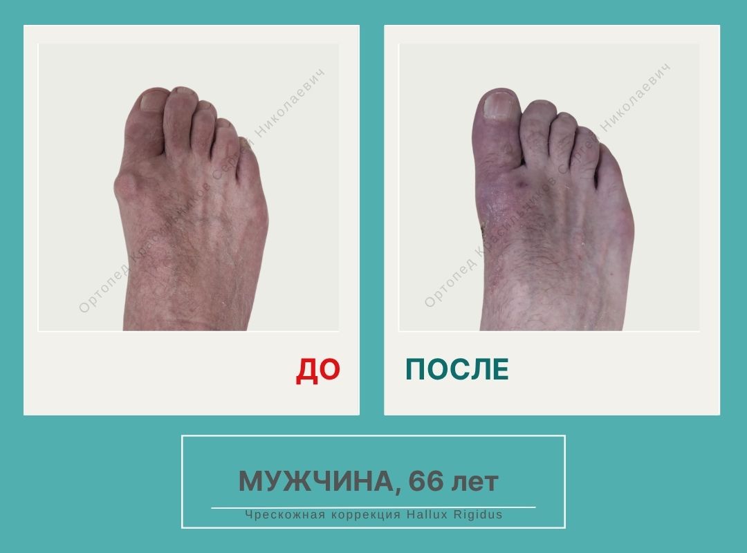 КСН ДО ПОСЛЕ НА САЙТ_Кислицын В.А.