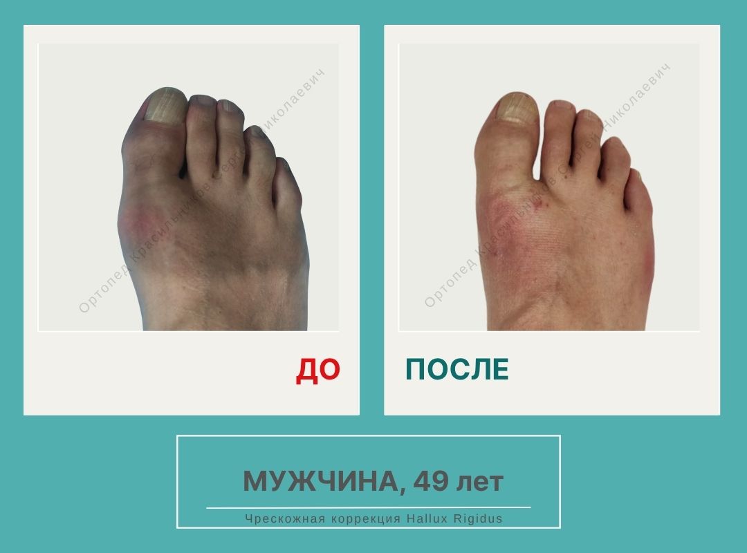 КСН ДО ПОСЛЕ НА САЙТ_Семенихин М.А.