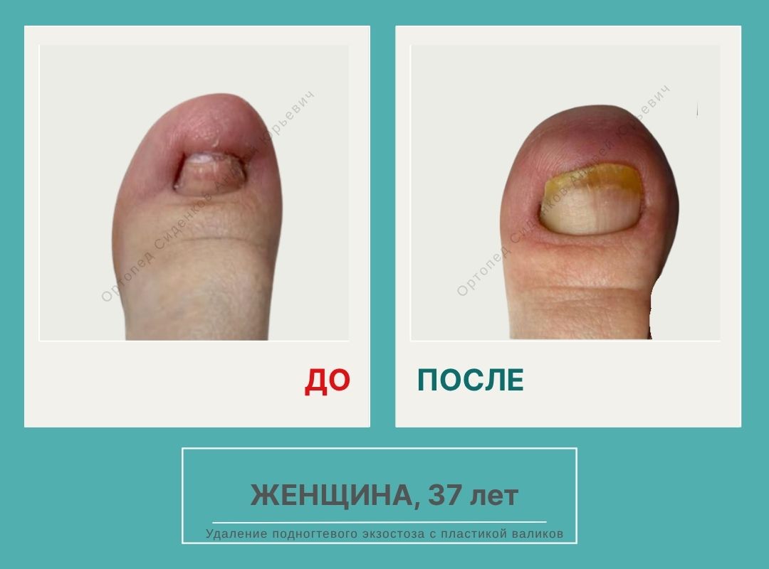 НОГТИ НА САЙТ_3