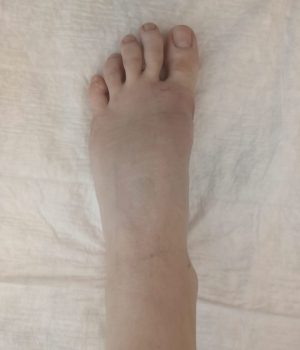 PHOTO-2019-08-07-ПОСЛЕ